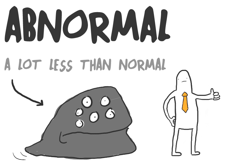 Abnormal Font
